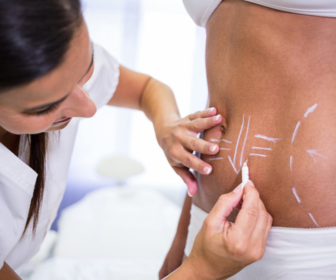 Considering Cosmetic Surgery in Dubai: My Personal Journey and What You Need to Know