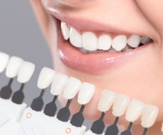 teeth whitening dubai